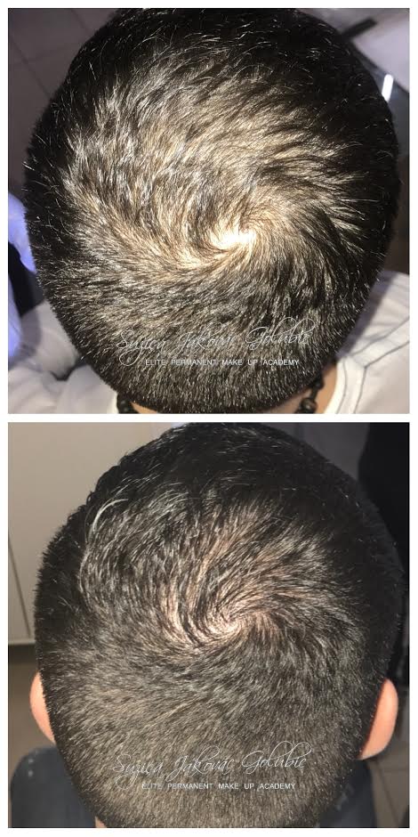 Kosa-scalp